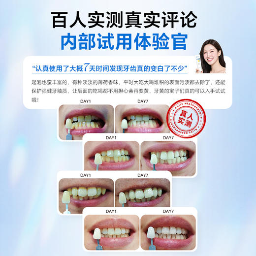 复因FOY 炫白去渍牙膏 120g/支 溶渍美白 刷出亮白牙 商品图5