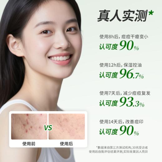 【新人专享 39/件 59/2件】Lab101瑞沛水杨酸祛痘膏20g 商品图2