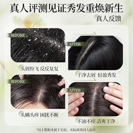 霸王去屑止痒洗发液1L 商品图4