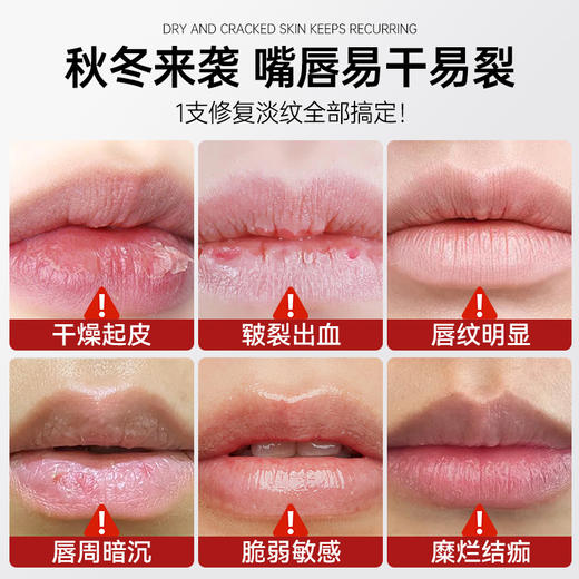 野森博士-唇部舒润啫喱  富含多种珍贵滋养成分 拒绝干燥  起皮干裂 商品图1