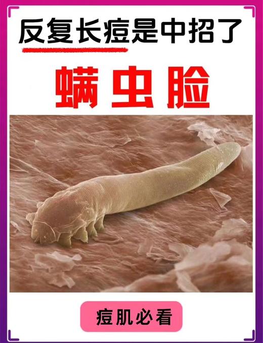 莱微妮-层孔菌蛹虫草毛孔清肌套 面部套院用 商品图5