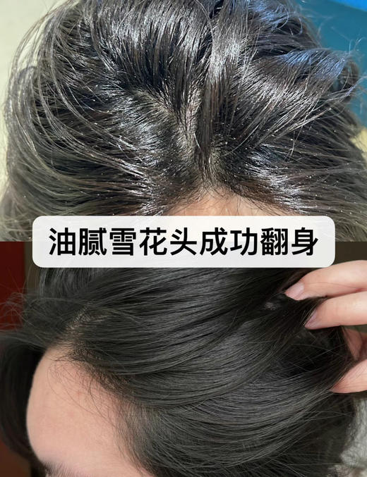 到手四瓶共60ml❗️【激活毛囊瓶】丝丽小红帽头皮赋活精华15ml/瓶 商品图4