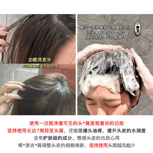 【10.5王炸割肉价】卡诗自在瓶80ml*3去屑（限26年5-6月） 商品图3