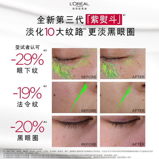 法国 L'OREAL欧莱雅 第3代紫熨斗玻色因全脸淡纹眼霜 30ml 商品图5