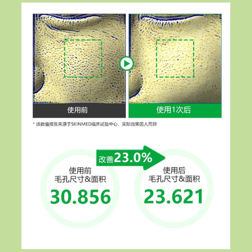 【sungboon绿番茄毛孔收缩】检测报告具有毛孔紧致的效果 湖州仓 商品图3