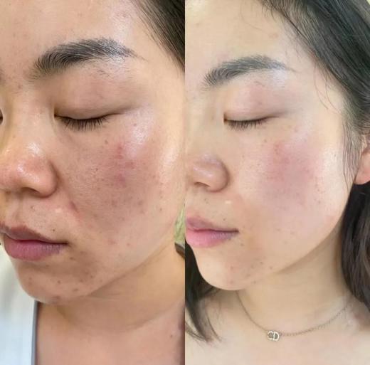 【多妈团购 NA蔓越莓胶原蛋白软糖 独立包装更卫生】德国原装进口，浓缩蔓越莓汁+深海鱼胶原蛋白+重瓣玫瑰花，促进私处微生态平衡，预防私密感染 守护女性健康，康恢复肌肤弹润-美初 商品图4