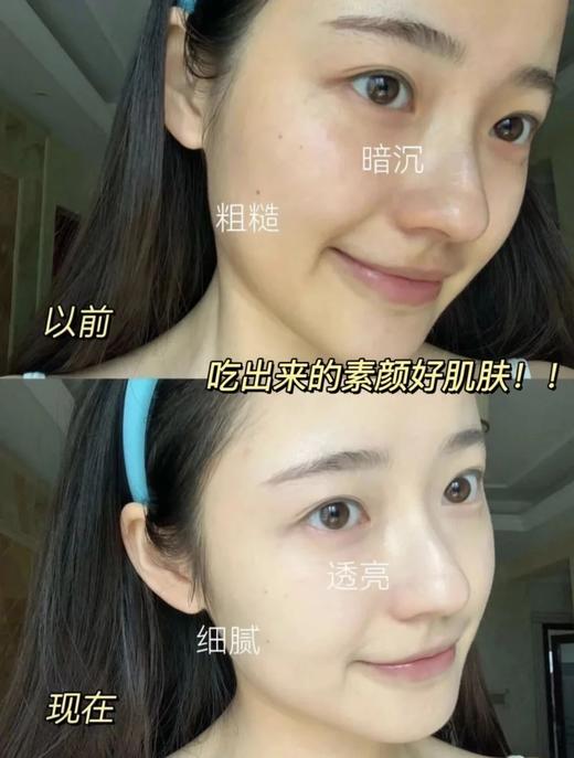 【多妈团购 NA蔓越莓胶原蛋白软糖 独立包装更卫生】德国原装进口，浓缩蔓越莓汁+深海鱼胶原蛋白+重瓣玫瑰花，促进私处微生态平衡，预防私密感染 守护女性健康，康恢复肌肤弹润-美初 商品图3