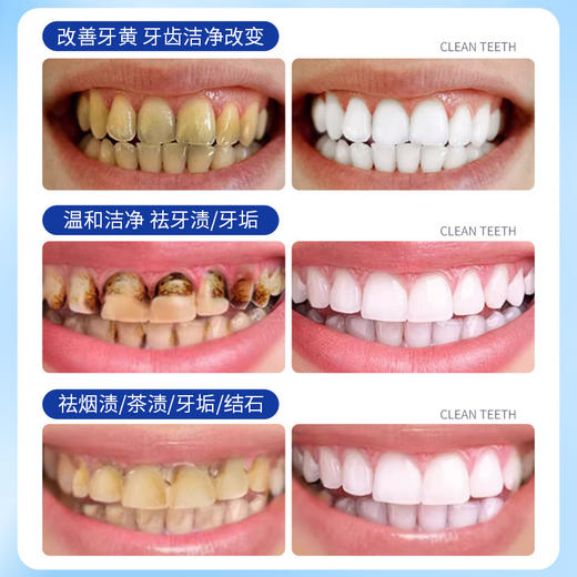  买一送一！【牙齿焕新计划✨】碧素堂海盐薄荷牙膏🔥小苏打加持，烟渍茶渍说拜拜！清新口气从早到晚💎260g大容量，海盐薄荷味小苏打牙膏 去渍牙膏，温和洁净不伤牙🦷 商品图2