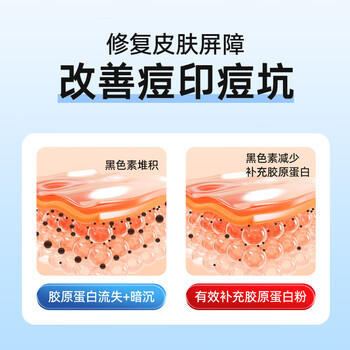 Newliann医用械字号面膜冷敷贴医美术后修复保湿补水晒后三型重组胶原蛋白 /医疗保健 /保健器械 /医用美护 商品图5