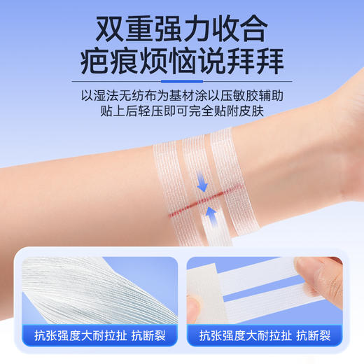 可孚医用减张贴儿童伤口愈合免缝胶带布术后祛疤疤痕增生皮肤祛痣 商品图3