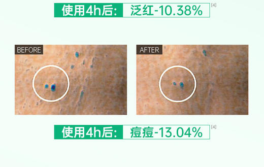 【升级礼包】舒缓控油洁面乳245g 祛痘CP 商品图2