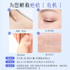 可孚颜本舒透明质酸硅凝胶医用去疤剖腹产疤痕祛疤膏硅酮凝胶敷料 商品缩略图2