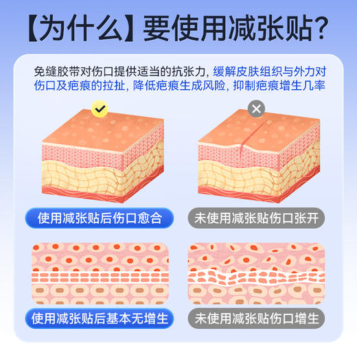 可孚医用减张贴儿童伤口愈合免缝胶带布术后祛疤疤痕增生皮肤祛痣 商品图2