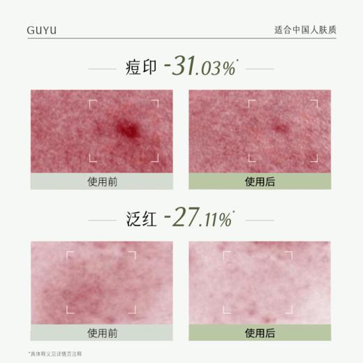 【周四限定】谷雨白千控油水乳 美白淡化痘印白千水淡印乳 商品图6