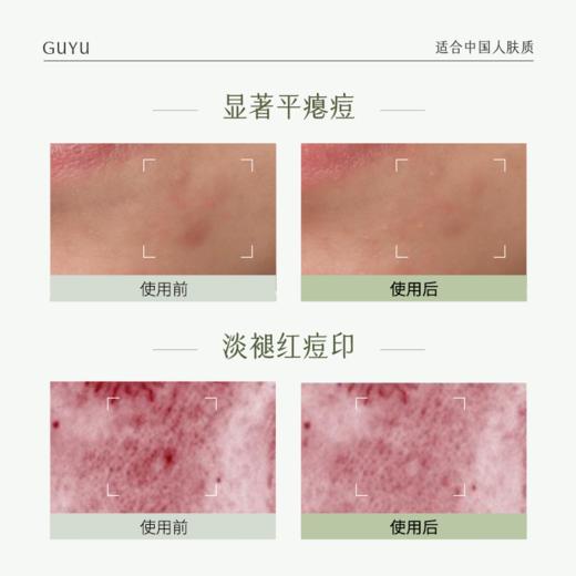 【双十二狂欢节】谷雨白千淡印乳 净颜美白淡印细肤乳100ml 淡痘印 修痘损 焕现匀净柔光肌 商品图5