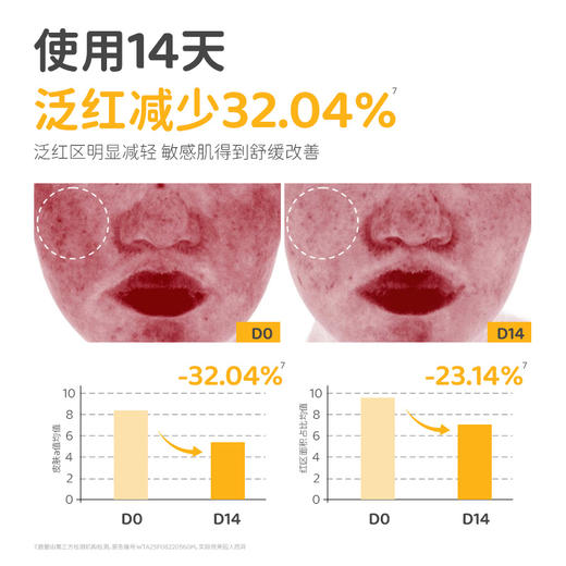 ⁵【蓓雀儿-安心霜】泛红/干燥/痒 日常护理用  仿生胎脂+燕麦β-葡聚糖+龙胆根 0岁以上儿童【蓓雀儿】 YY05-QTT-BQR 商品图3