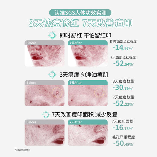 【青少年祛痘面霜】7天控油祛痘修红 袋鼠妈妈安肌沁润霜50g 商品图4