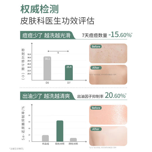 【TOP登陆少年组合同款】专研青少年背痘 无酸祛痘 夏季控油清爽 袋鼠妈妈祛痘净澈沐浴露380ml 商品图2