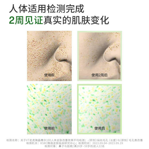 韩国 VT范特 保湿提亮微针精华 50ml 100针/300针 商品图2