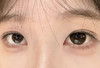 KAYLENS可爱巧（佩戴直径：14.5mm） 商品缩略图2
