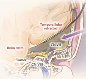 经迷路入路 全面观察 商品图0