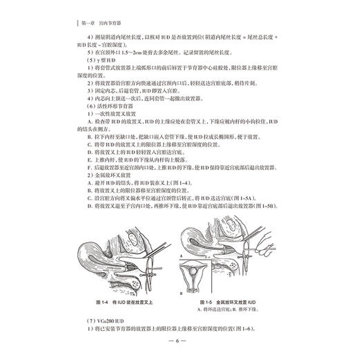 临床诊疗指南与技术操作规范 计划生育分册 第2二版 中华医学会计划生育学分会编写 西医 妇产科学 9787117384544 人民卫生出版社 商品图4