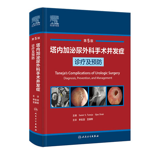 塔内加泌尿外科手术并发症诊疗及预防 商品图0