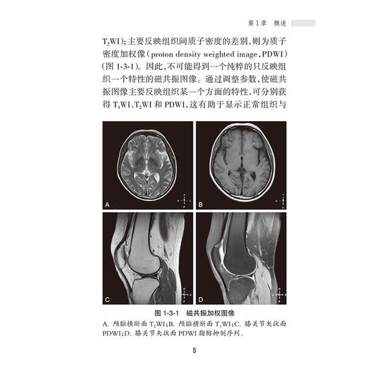 临床医生MRI掌中宝 刘波 钟治平 主编 介绍各系统疾病的MRI典型表现和主要鉴别诊断要点 临床医学 9787117384520 人民卫生出版社 商品图4