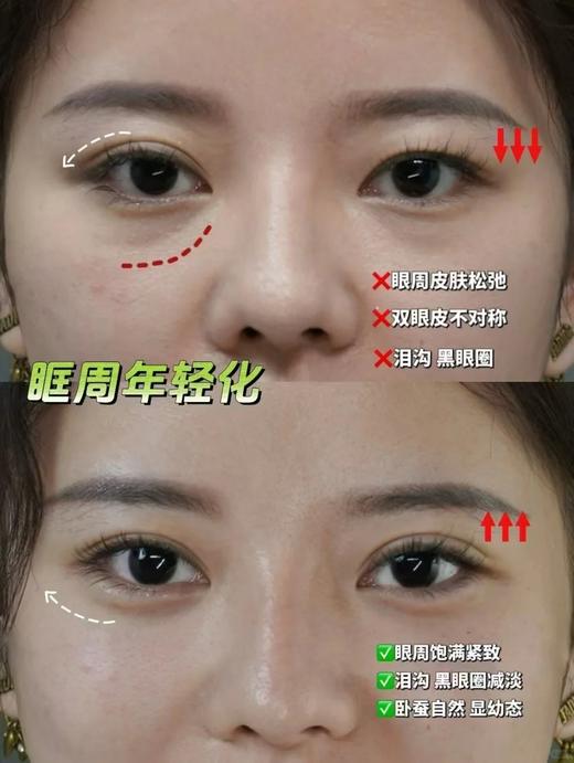 【清仓好价】艾科美臻颜眼霜15ml（效期至26.8） 商品图2