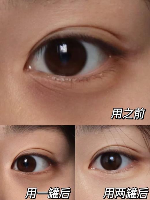 【清仓好价】艾科美臻颜眼霜15ml（效期至26.8） 商品图3