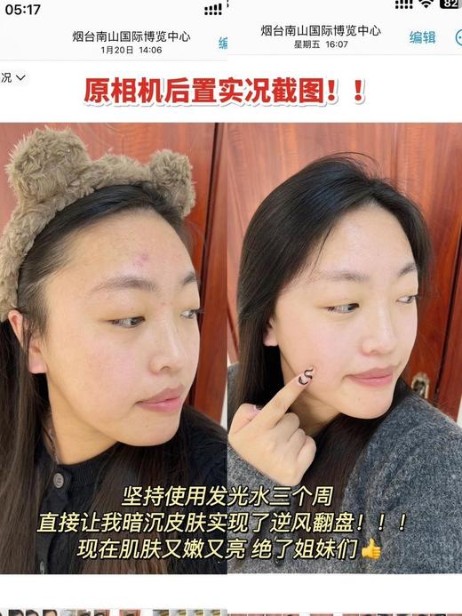 【多妈团购 HBN·α-熊果苷焕颜精萃水2.0-150ml+送小样】去黄气，去暗沉，去班味儿，皮肤越用越亮！清透水润不粘腻，流动性超好，研Hepes“透皮技术+108.9%“吸收率-咸喜仓 商品图13