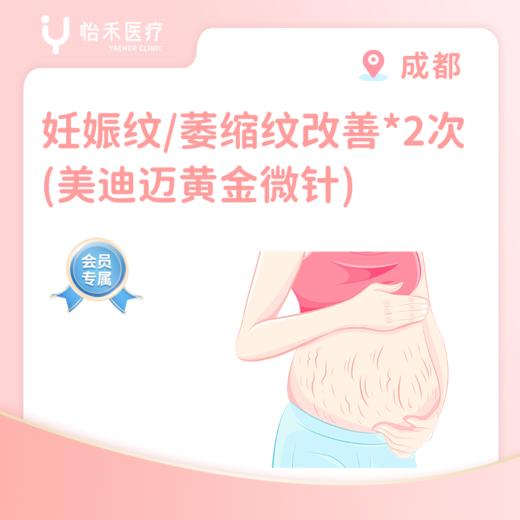 成都【会员】妊娠纹/萎缩纹改善*2次（美迪迈黄金微针 ） 商品图0