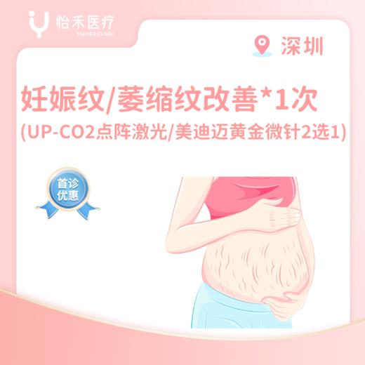 深圳【首诊】妊娠纹/萎缩纹改善*1次（UP-CO2点阵激光/美迪迈黄金微针2选1 ） 商品图0
