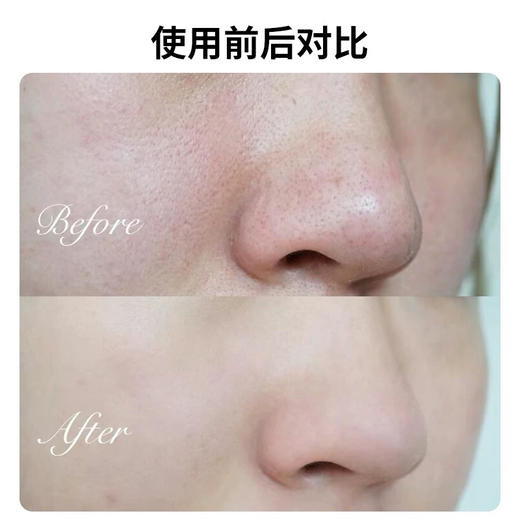 日本 Labo Labo城野医生 收缩毛孔 精华爽肤水 200ml/400ml 商品图2