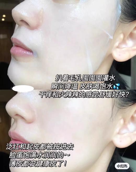 【清仓好价】韩国多特海伦舒缓抗皱面膜5片盒装*3盒（效期至25.11） 商品图4