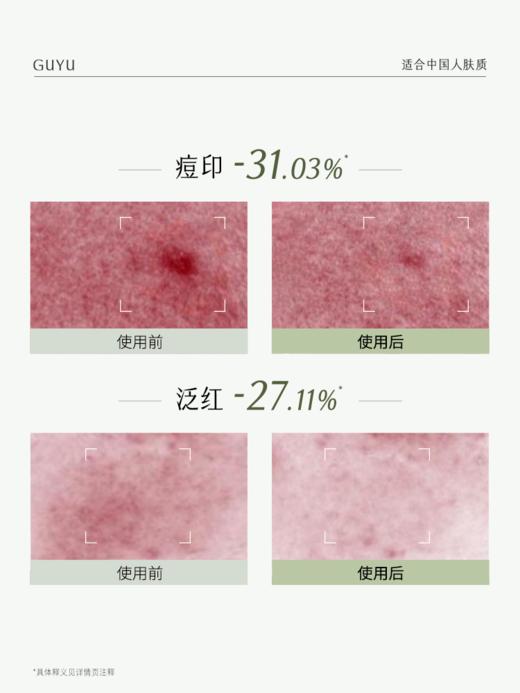 仅限周四【美美星期四】白千水150ml*2 +白千霜50g+白千乳50ml+冰绷带面膜3片+小绿灯精华1.5ml*3  商品图3