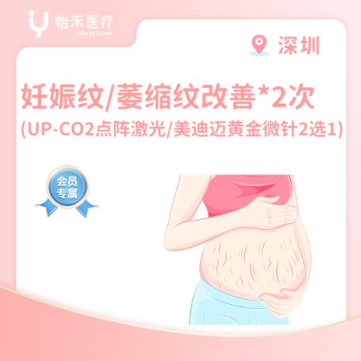 深圳【会员】妊娠纹/萎缩纹改善*2次（UP-CO2点阵激光/美迪迈黄金微针2选1 ） 商品图0