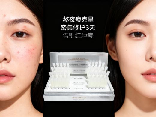 胶态硫祛痘舒缓精粹液 商品图5