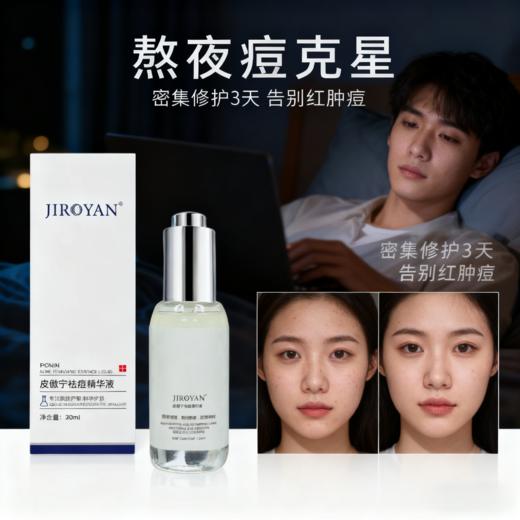 皮傲宁祛痘精华液 商品图5