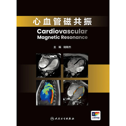 心血管磁共振 商品图1