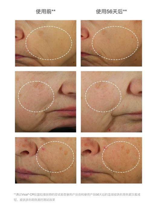 cellcosmet瑞妍白皙焕靓精华液 商品图2