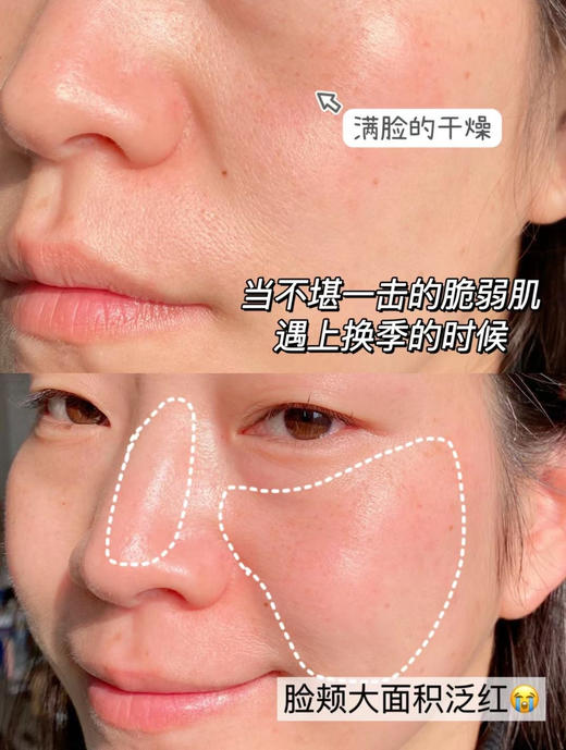 【敏感肌水乳套装】润百颜玻尿酸屏障调理水乳 商品图3