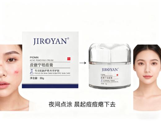 皮傲宁祛痘膏 商品图5