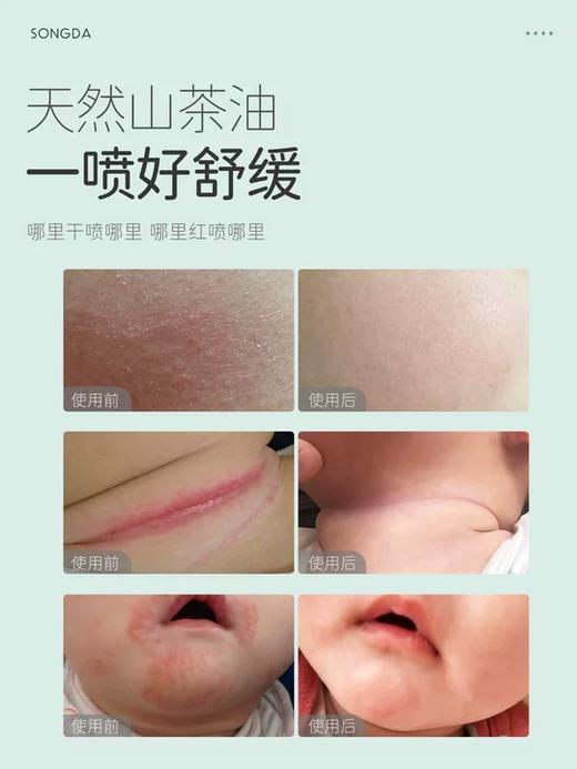 松达婴儿护肤山茶油50ml 商品图2