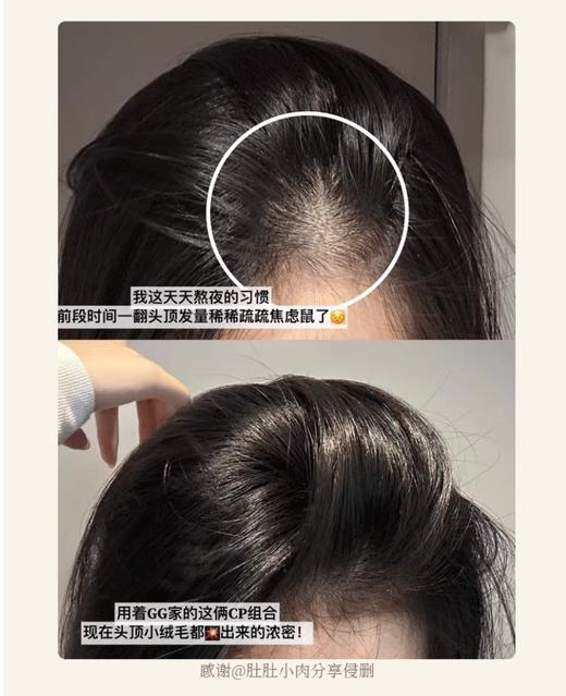 【清仓好价】GrowGorgeousgg强效增发精华修护改善头皮环境强韧发丝60ml 商品图3