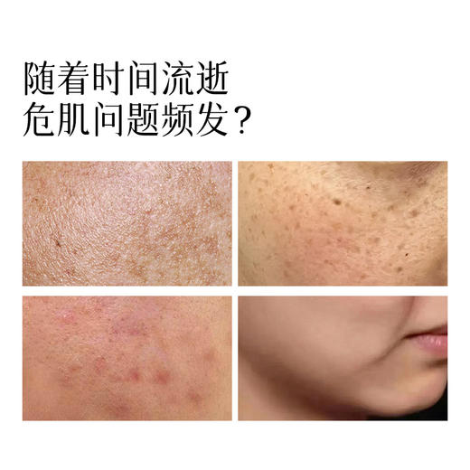 养瑞和 | 净颜瓷肌精华液30ml·小白瓶·烟酰胺577·曲克芦丁·德敏舒·光甘草定·α熊果苷·依克多因·三重积雪草·乳酸杆菌发酵产物·透明质酸钠 商品图4