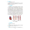冲击波球囊成形术：冠状动脉钙化病变的精准干预与临床实践 薛亚军 王伟民 杨宏辉 主编 9787521455229 中国医药科技出版社 商品缩略图4