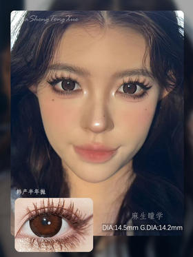 DORISCON暖阳玫瑰（佩戴直径：14.5mm）