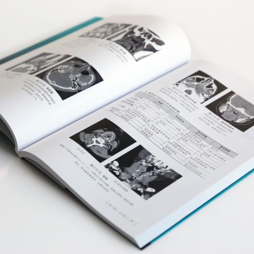 影像鉴别诊断一目了然系列--CT鉴别诊断一点通（第四版） 商品图5