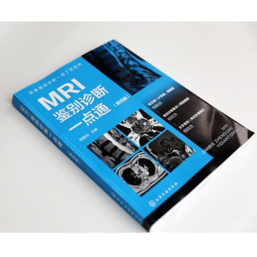 影像鉴别诊断一目了然系列--MRI鉴别诊断一点通（第四版） 商品图4